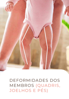 Deformidades dos membros